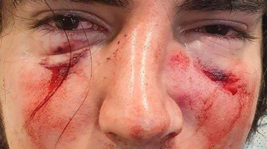 Un joven de 18 años fue brutalmente golpeado por un grupo de rugbiers en un country de Córdoba