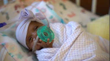 La bebé "más pequeña del mundo" que pesó 245 gramos al nacer y sobrevivió contra todas las expectativas
