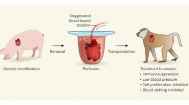 Un paso más cerca para el uso de corazones de cerdos en el trasplante humano