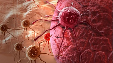 La expansión de las células tumorales no respeta las leyes de la física