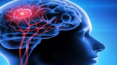 Cerebro: Un estudio reveló nueva información sobre el Parkinson
