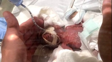 El bebé "más pequeño del mundo": dan de alta a un recién nacido que pesó solo 268 gramos en Japón