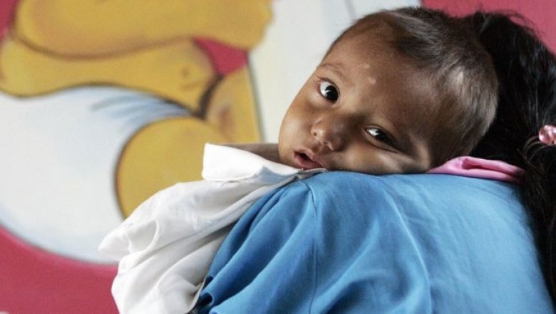 Guatemala: por qué los niños de este país son los que más desnutrición crónica sufren en América Latina