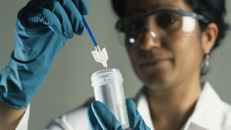 El "prometedor" test casero alternativo a la prueba de Papanicolau que puede ayudar a más mujeres a saber si tienen cáncer