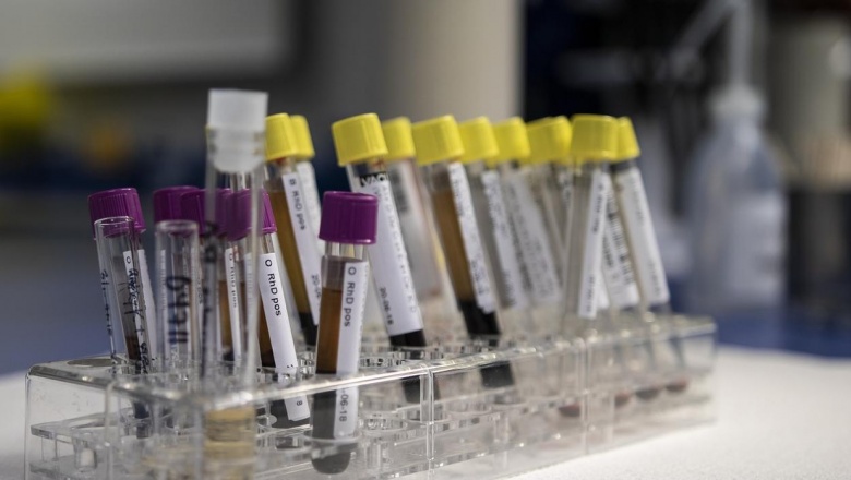 El análisis de sangre que predice nuestra salud futura