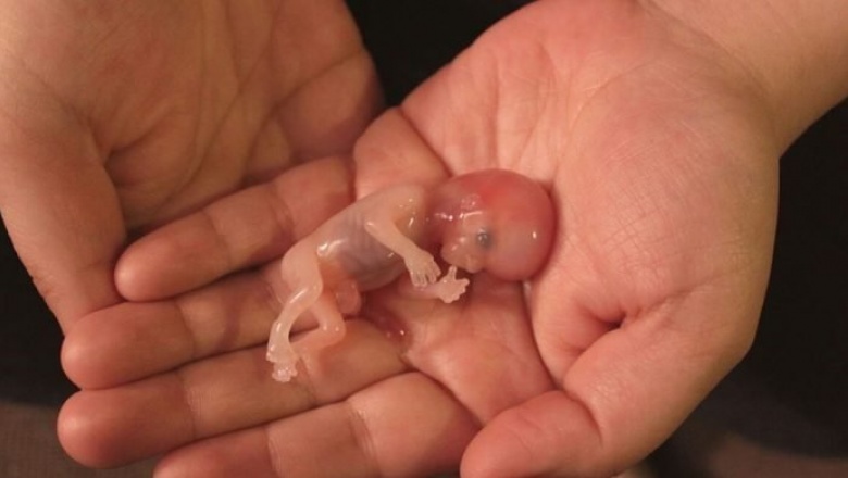 Lo que no se dice sobre el aborto