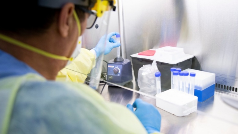 Testeos centinelas: En 20 minutos se podrá saber si una persona tuvo contacto con el virus o no
