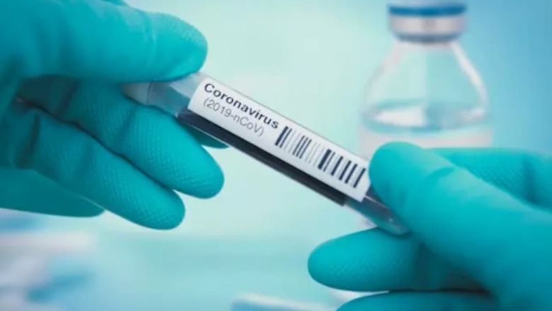 El Ministerio de Salud de Nación confirmó  1.141 nuevos casos de coronavirus