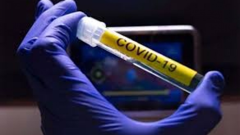 Parte diario de situación de Coronavirus