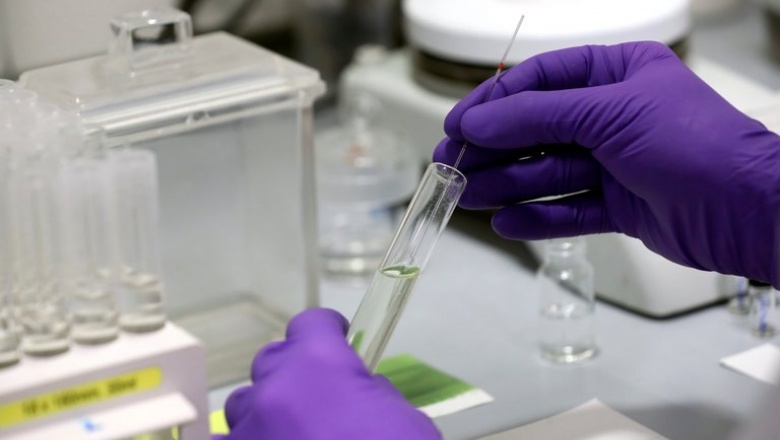 Los 16 desarrollos biotecnológicos de la ciencia argentina durante la pandemia