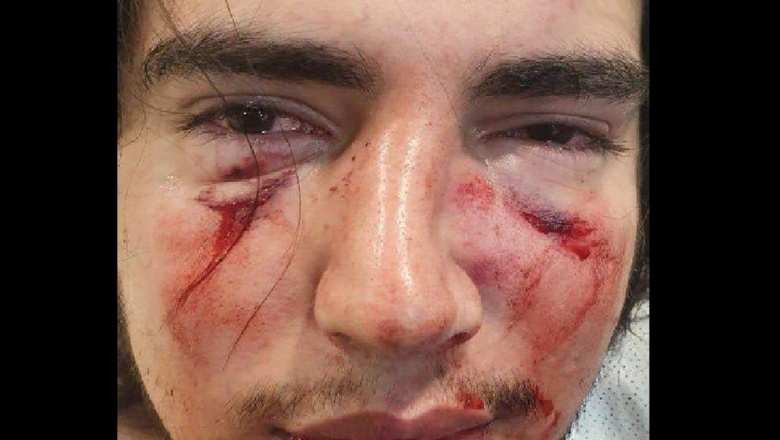 Córdoba. Por la golpiza a un joven imputan a dos rugbiers, uno de ellos, hijo de un ex Puma