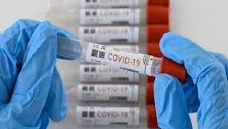 Parte diario provincial de situación de covid-19
