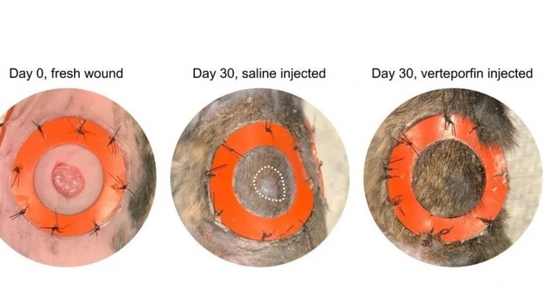 Las cirugías sin cicatrices serían una realidad posible