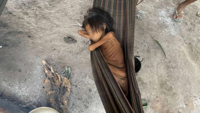 La impactante foto de una nena de 8 años que pesa 12 kilos: los estragos de la minería ilegal y el coronavirus en los yanomamis de Brasil
