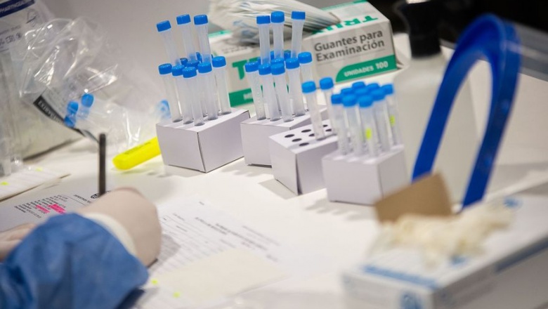 Confirmaron 67 muertes y 1.397 contagios en las últimas 24 horas
