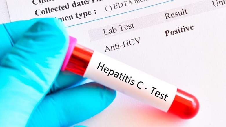 Aprobaron un test rápido para detectar un virus silencioso que afecta a cientos de miles de argentinos