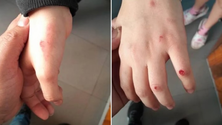 Bullying, violencia y miedo: El calvario de una alumna que fue golpeada por tres compañeras y nadie la ayudó