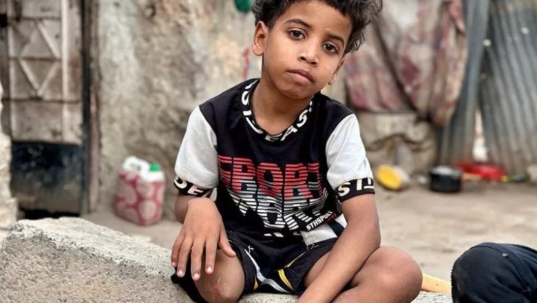 "Si el sufrimiento tuviera una dirección sería la calle al-Rasheed en Yemen"