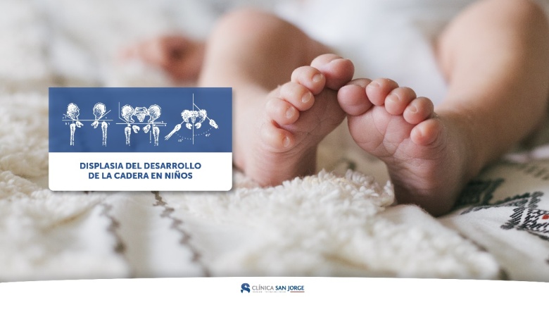 Clínica San Jorge y HRU colaboran en ateneo sobre displasia de cadera en niños
