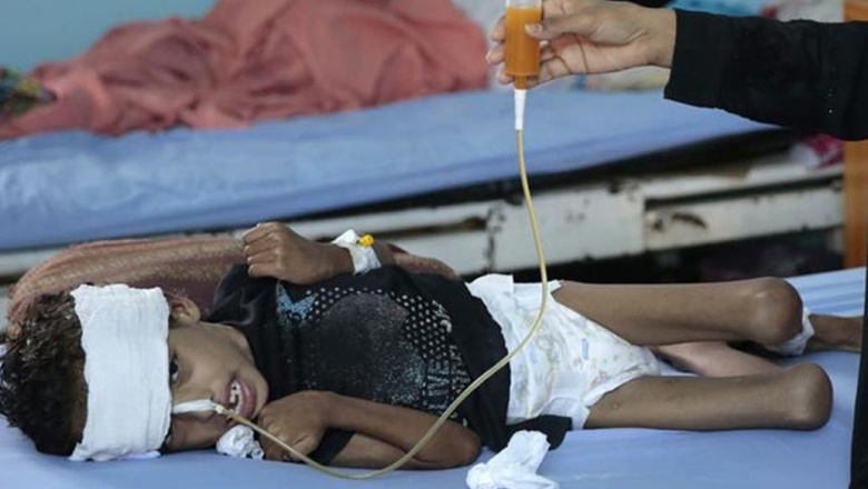 Yemen: 85 mil niños habrían muerto de hambre en los últimos años