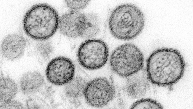 Hantavirus : por qué preocupa el brote que ha causado la muerte de 9 personas