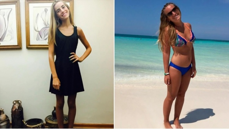 Mostró los estragos de la anorexia y causó revuelo en las redes