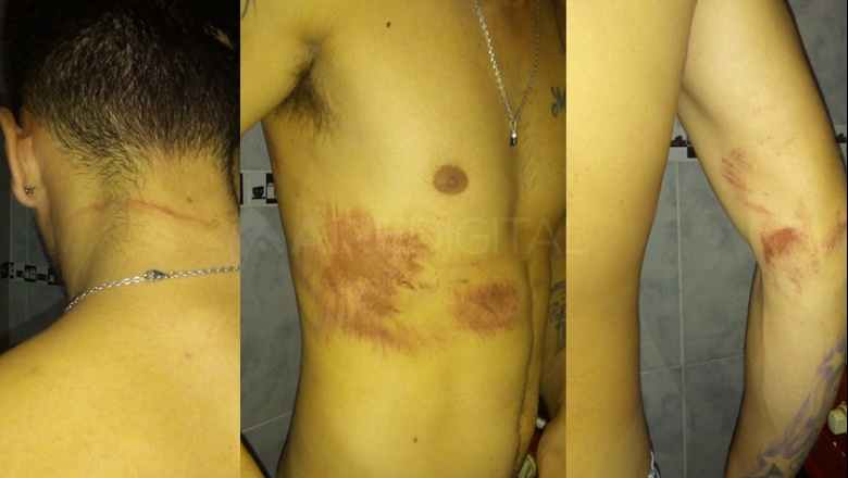 "Mirá cómo lloran los maricones": bestial ataque y violación policial a una pareja gay en Santa Fe