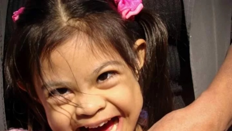 Dos papás adoptaron a una nena con síndrome de down y a fuerza de amor, logró caminar y empezar a hablar