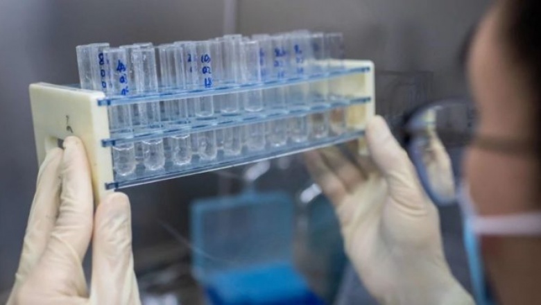 El Ministerio de Salud informó 3449 nuevos casos de Covid-19