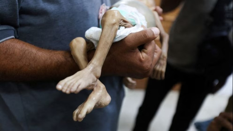 El hambre azota a los hospitales de Gaza: no hay alimentos, las enfermeras se desmayan y escasea la leche para bebés