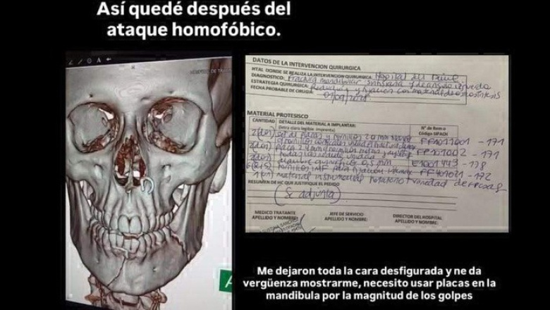 Brutal golpiza a un joven gay en Palermo
