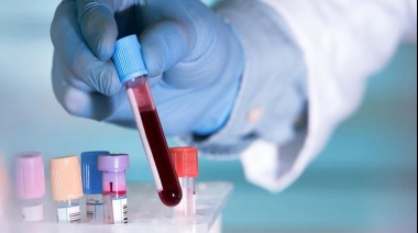 Un nuevo test de sangre permite la detección temprana de 50 tipos de cáncer