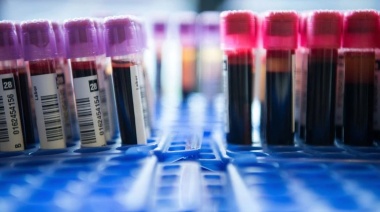 Solo con una gota de sangre: Un prometedor test permite la detección temprana de 50 tipos de cáncer