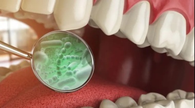 Cáncer de colon y otras 3 enfermedades vinculadas con las bacterias que se encuentran en tu boca