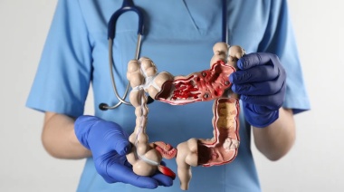 Identifican las células malignas que se desprenden del cáncer de colon y provocan las muertes por metástasis