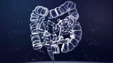 Cáncer de colon: Alertan por el aumento de casos detectados en personas jóvenes