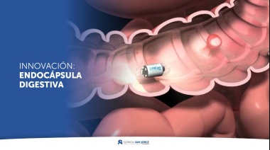 Clínica San Jorge incorporó nueva tecnología de endocápsulas digestivas