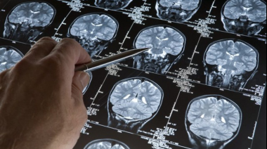 Alzheimer: Descubren lo que causa la muerte de células cerebrales y la demencia