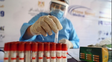 Covid-19: un estudio argentino demuestra que 95% de pacientes desarrolló anticuerpos a los 45 días
