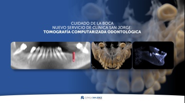 Clínica San Jorge incorporó la tomografía computarizada odontológica