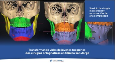 Transformando vidas: dos nuevas cirugías ortognáticas en Clínica San Jorge