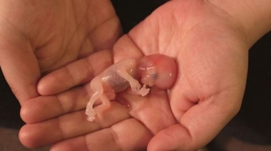 Lo que no se dice sobre el aborto