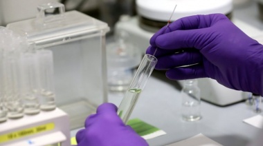 Los 16 desarrollos biotecnológicos de la ciencia argentina durante la pandemia