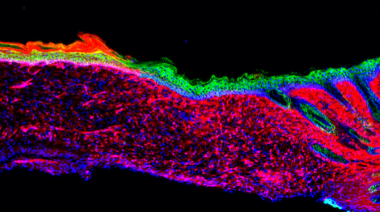 Crean piel nueva reprogramando las células de una herida abierta