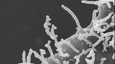 Sorprendentes fotos de cómo ataca el coronavirus a las células humanas