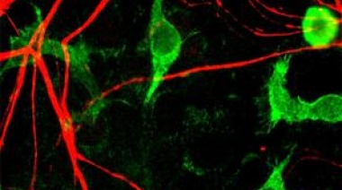 La obesidad favorecería la pérdida de conexiones neuronales