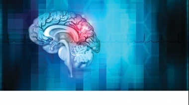 ACV y tratamiento: se cuadruplicó el tiempo de la "ventana terapéutica" para tratar el accidente cerebrovascular