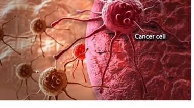Test genómico predice qué pacientes con cáncer responderán a la inmunoterapia