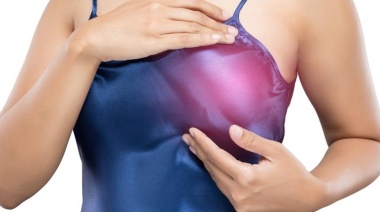 Un fármaco guía al sistema inmune para que ataque de forma selectiva al cáncer de mama