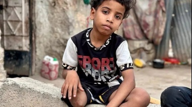 "Si el sufrimiento tuviera una dirección sería la calle al-Rasheed en Yemen"